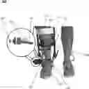 Fig. 01 - ORTHOTIC DEVICES AND METHODS OF USING THE SAME