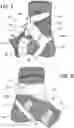 Fig. 03 - ANKLE SUPPORT AND METHOD FOR SECURING THE SAME