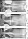 Fig. 05 - Adjustable back brace and methods for use thereof