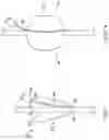 Fig. 05 - STOMA SITE PROTECTION DEVICES AND METHODS