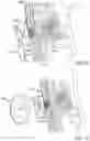 Fig. 14 - STOMA SITE PROTECTION DEVICES AND METHODS