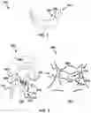 Fig. 02 - Device and method for correcting obstructive sleep apnea