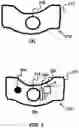Fig. 03 - Device and method for correcting obstructive sleep apnea
