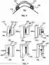 Fig. 06 - Device and method for correcting obstructive sleep apnea