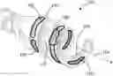 Fig. 01 - Apparatus and method for treating or/and refreshing an ear canal