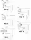 Fig. 07 - Apparatus and method for application of absorbent article