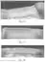Fig. 13 - ABSORBENT ARTICLE WITH WAISTBAND