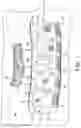 Fig. 02 - TETHERED SURGICAL SPONGES