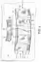 Fig. 03 - TETHERED SURGICAL SPONGES
