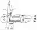 Fig. 05 - Device for supporting both arms of a user