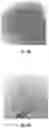 Fig. 07 - Biodegradable drug eluting microsphere for the treatment of solid tumors