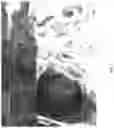 Fig. 08 - Composition and methods for the treatment of peripheral nerve injury