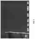 Fig. 09 - Composition and methods for the treatment of peripheral nerve injury