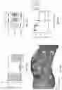 Fig. 18 - Composition and methods for the treatment of peripheral nerve injury