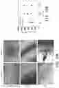 Fig. 16 - Hybrid hydrogel and method of fabricating the same