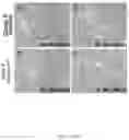 Fig. 02 - Method for the treatment of fatty liver disease