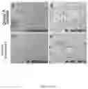 Fig. 04 - Method for the treatment of fatty liver disease
