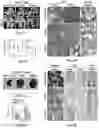 Fig. 06 - Compositions and methods for promoting bone regeneration