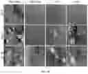 Fig. 09 - Compositions and methods for promoting bone regeneration
