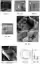 Fig. 12 - Compositions and methods for promoting bone regeneration