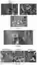 Fig. 15 - Compositions and methods for promoting bone regeneration