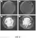 Fig. 05 - METHOD FOR TREATMENT OF DISEASE CAUSED OR AGGRAVATED BY MICROORGANISMS OR RELIEVING SYMPTOMS THEREOF