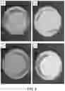 Fig. 07 - METHOD FOR TREATMENT OF DISEASE CAUSED OR AGGRAVATED BY MICROORGANISMS OR RELIEVING SYMPTOMS THEREOF