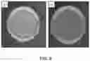 Fig. 09 - METHOD FOR TREATMENT OF DISEASE CAUSED OR AGGRAVATED BY MICROORGANISMS OR RELIEVING SYMPTOMS THEREOF