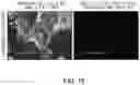Fig. 16 - METHOD FOR TREATMENT OF DISEASE CAUSED OR AGGRAVATED BY MICROORGANISMS OR RELIEVING SYMPTOMS THEREOF