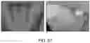 Fig. 22 - METHOD FOR TREATMENT OF DISEASE CAUSED OR AGGRAVATED BY MICROORGANISMS OR RELIEVING SYMPTOMS THEREOF