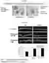 Fig. 03 - Use of pridopidine to improve cognitive function and for treating Alzheimer's disease