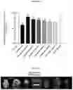 Fig. 07 - Use of pridopidine to improve cognitive function and for treating Alzheimer's disease