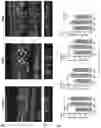 Fig. 09 - ERBB3 Activators in Hearing Restoration