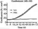 Fig. 01 - METHODS OF TREATING VESTIBULAR SCHWANNOMA