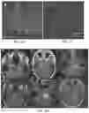 Fig. 07 - METHODS OF TREATING VESTIBULAR SCHWANNOMA