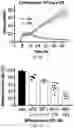 Fig. 11 - METHODS OF TREATING VESTIBULAR SCHWANNOMA