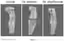 Fig. 12 - Compositions of oligofructose and commensal microorganisms and methods thereof