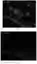 Fig. 22 - COMPOSITIONS AND METHODS FOR TREATING ALZHEIMER'S DISEASE