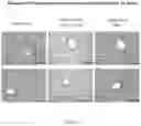 Fig. 12 - Method for detecting whether glucose metabolism is abnormal, and prevention and treatment therefor
