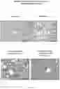 Fig. 13 - Method for detecting whether glucose metabolism is abnormal, and prevention and treatment therefor