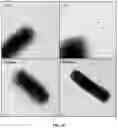Fig. 09 - Vaccine against necrotic enteritis in poultry