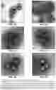 Fig. 02 - Vaccine Containing Virus-Like Particles