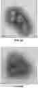 Fig. 06 - Vaccine Containing Virus-Like Particles
