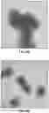 Fig. 07 - Vaccine Containing Virus-Like Particles