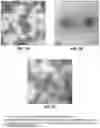 Fig. 08 - Vaccine Containing Virus-Like Particles