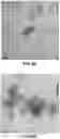 Fig. 09 - Vaccine Containing Virus-Like Particles