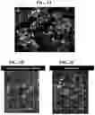 Fig. 06 - Gene therapy for treating peroxisomal disorders