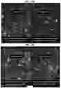 Fig. 07 - Gene therapy for treating peroxisomal disorders