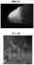 Fig. 09 - Gene therapy for treating peroxisomal disorders