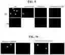 Fig. 13 - Gene therapy for treating peroxisomal disorders